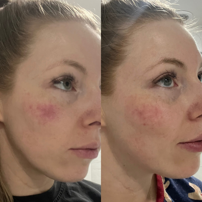 Unflavoured Collagen Bundle